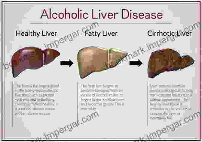 Alcohol's Damaging Effects On The Liver Regulating Lifestyle Risks: The EU Alcohol Tobacco And Unhealthy Diets