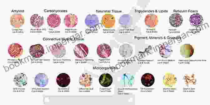 Pathological Specimens Of Various Tissues Motor Speech DisFree Downloads E Book: Substrates Differential Diagnosis And Management