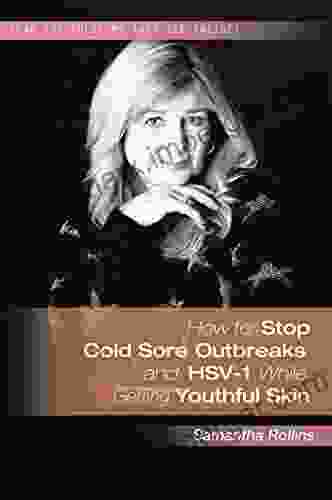 How To Stop Cold Sore Outbreaks And Hsv 1 While Getting Youthful Skin